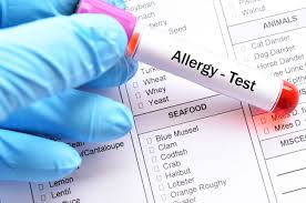 allergist
