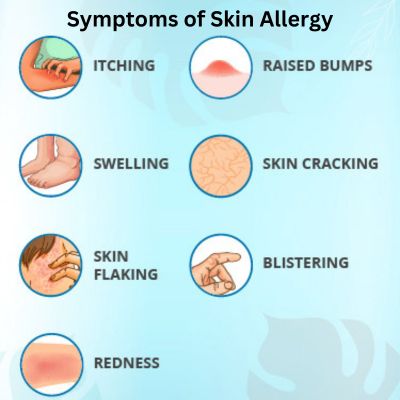 Skin Allergy Specialist