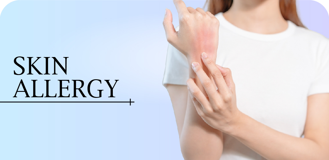 Skin Allergy Specialist